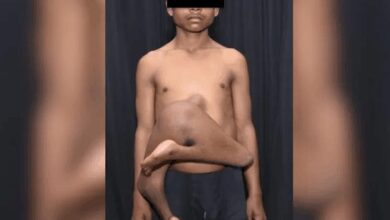 081232ba5k5vp0pxtazddo-RFyJH6.jpg