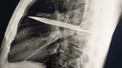 124334dytydivwdmq2txwk-IAF0X8.png